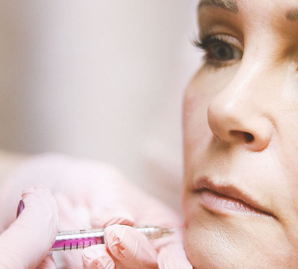 Dermal filler being injected along the lip and cheek