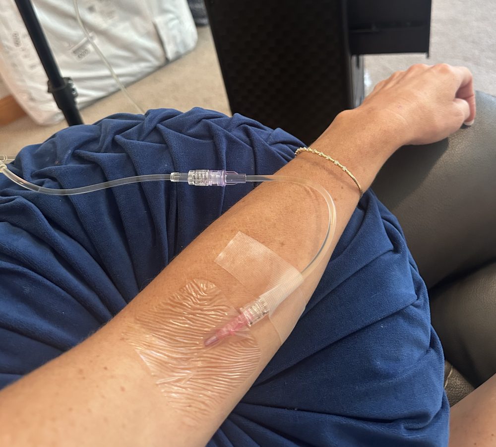 An IV hydration line taped in place on a client's forearm